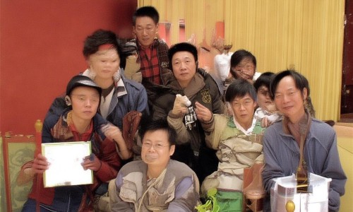 鼻综合手术全流程详解，从术前准备到术后恢复，一篇读懂美丽蜕变！